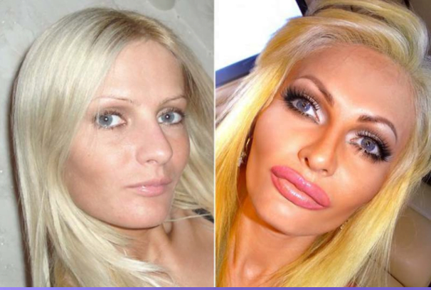 Latvian woman plastic surgery just to look like a sex doll 2